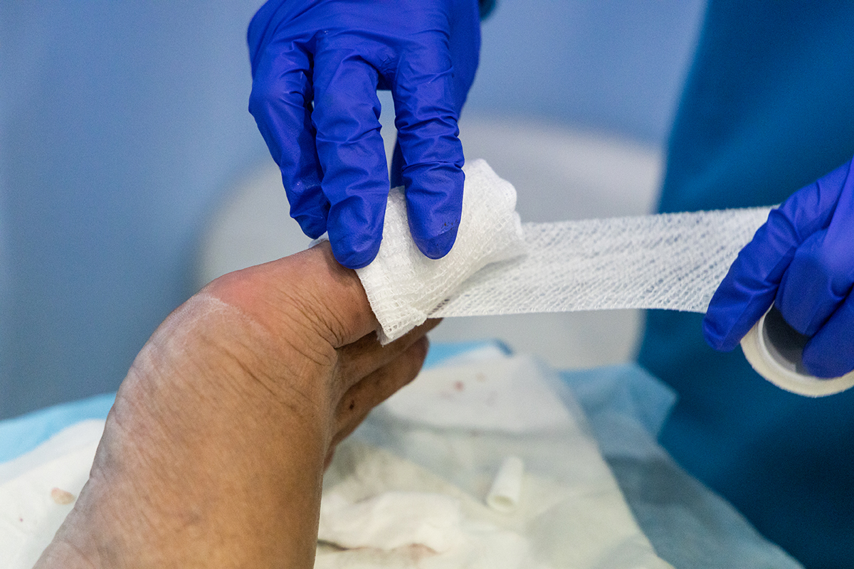Healthcare worker nursing toe with bandage gauz after ingrown toenail surgery in hospital